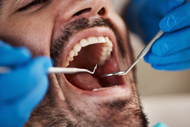 TMJ/TMD Treatment in Marlboro Village, MD